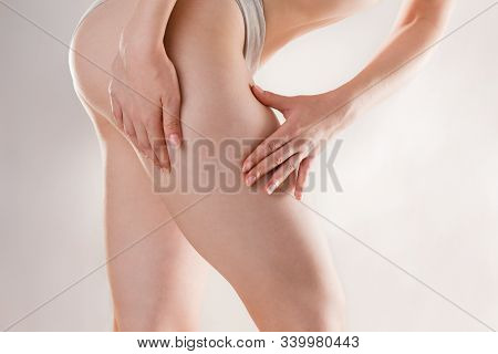 Medicine, Cosmetology And Cellulite. A Young Woman Of Athletic Build Squeezes The Skin On Her Thigh 
