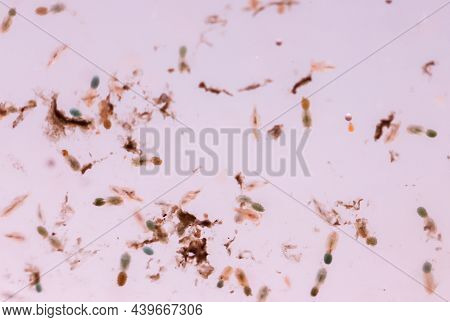 Close Up Of Rotifers, Rotifera In A Breeding Tank. Rotifers Are Zooplankton.