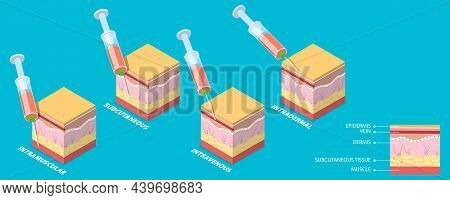 3d Isometric Flat Vector Conceptual Illustration Of Injection Types, Different Techniques Of Safe In