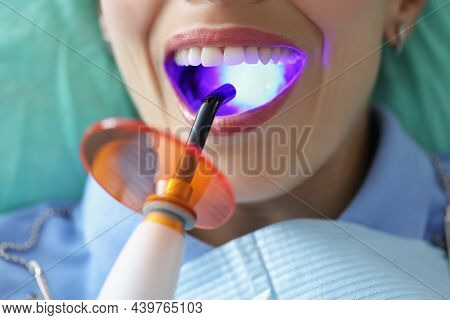 Close-up Of Woman With Open Mouth On Dentist Appointment Try Whitening Procedure. Special Tool With 