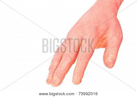 the hand