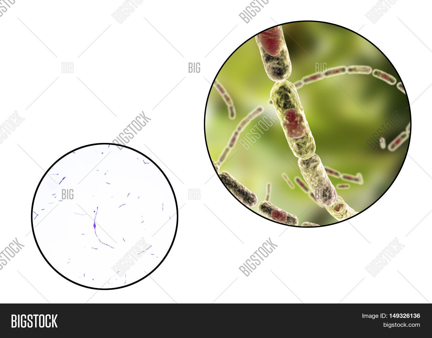 Bacillus Anthracis, Image & Photo (Free Trial) | Bigstock