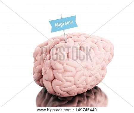 3D Illustration. Brain with a signboard and word migraine. Isolated white background.