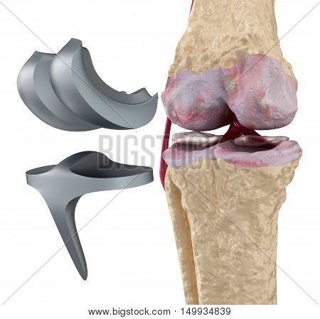 Knee and titanium hinge joint. Isolated on white