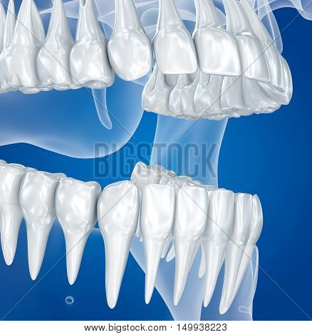 Transparent scull and teeth xray view . 3D illustration 