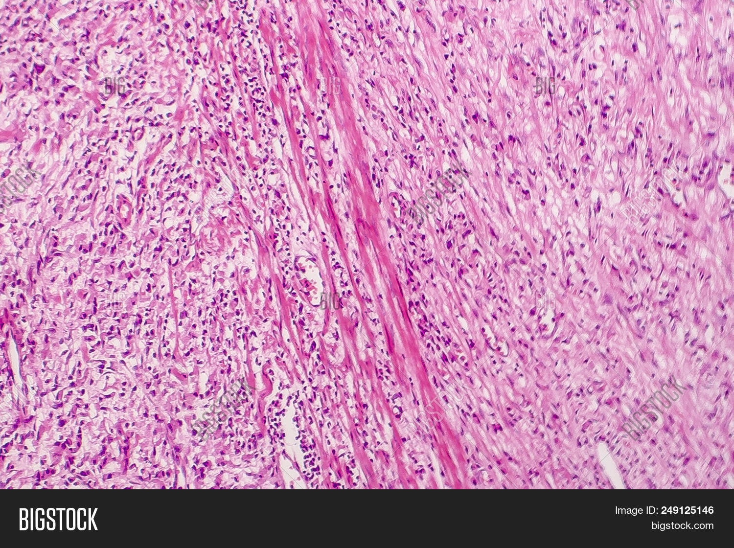 Ring Cell Image & Photo (Free Trial) Bigstock