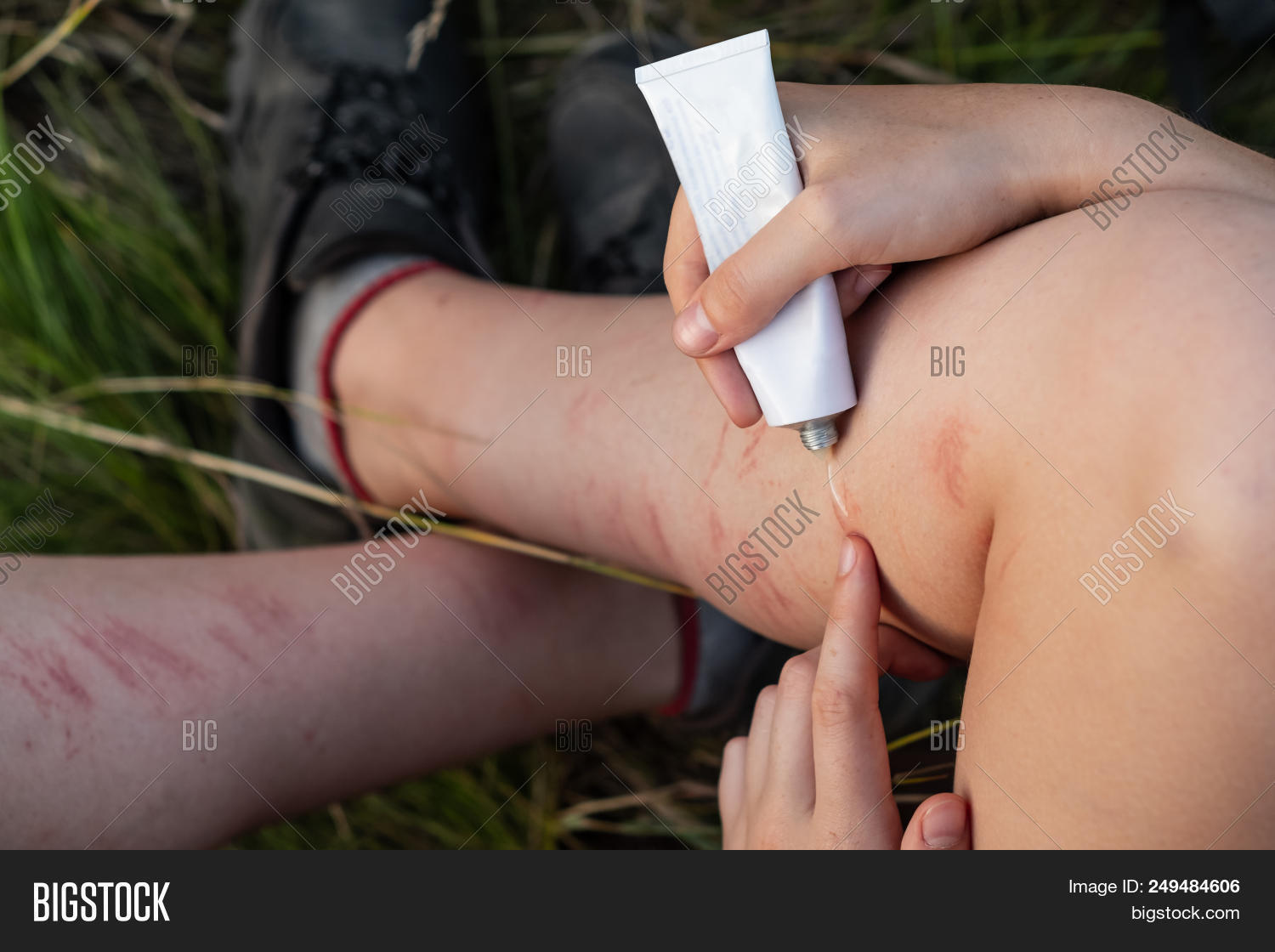 Applying First Aid Image & Photo (Free Trial) | Bigstock