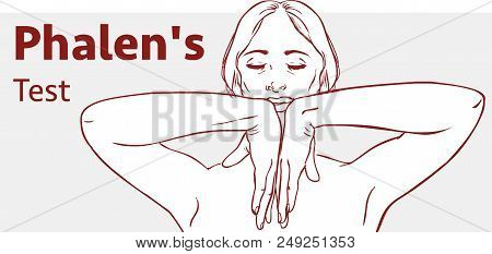 Stock Illustration Of Phalen's Test
