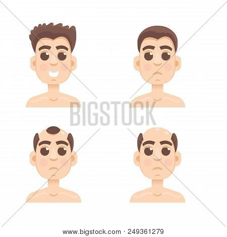 Hair Stages Loss. Types Of Baldness On Male Head Vector.