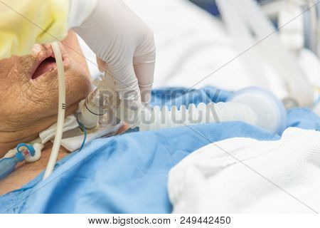 Patient Do Tracheostomy And Ventilator In Hospital