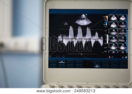 The Screen Of The Ultrasound Device With The Image Of Measuring The Pressure Gradient