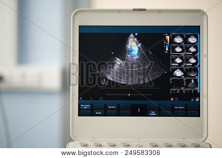 On The Screen Of The Ultrasound Device, A Heart Scan In A Four-chamber Position With A Demonstration