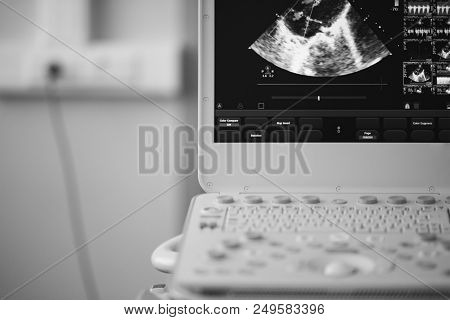 On The Ultrasound Screen, The Image Of The Heart In The Four-chamber Position And The Doppler Method
