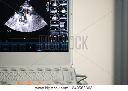 On The Screen Of A Modern Ultrasound Scanner, An Image Of The Heart Cavities With Red And Blue Strea