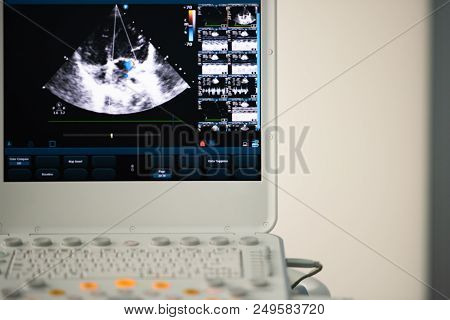 On The Screen Of The Ultrasound Scanner, The Image Of The Heart In The Four-chamber Position And Mar