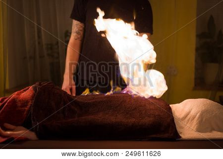 Chinese Fire Massage - Huo Liao Therapy. Traditional Chinese Medicine, Fire Treatment And Bodycare C