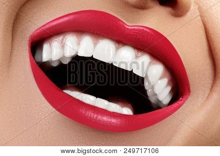 Dental Photo. Macro Happy Female Smile With Healthy White Teeth. Red Lips Make-up. Stomatology Treat