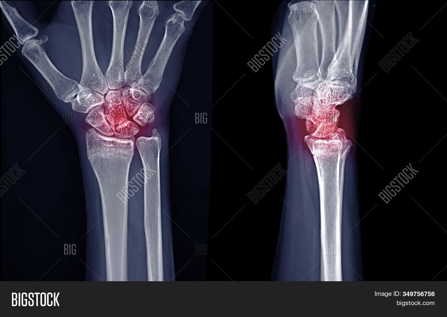 Xray Image Right Image & Photo (Free Trial) Bigstock