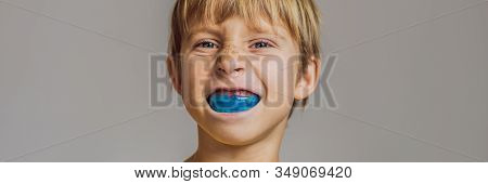 Six-year Old Boy Shows Myofunctional Trainer. Helps Equalize The Growing Teeth And Correct Bite, Dev