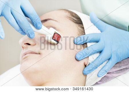 The Woman Undergoes The Procedure Of Medical Micro Needle Therapy With A Modern Medical Instrument D