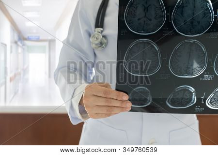 Doctor Check Up X-ray Film Of The Brain By Ct Scan Brain At Patient Room Hospital.