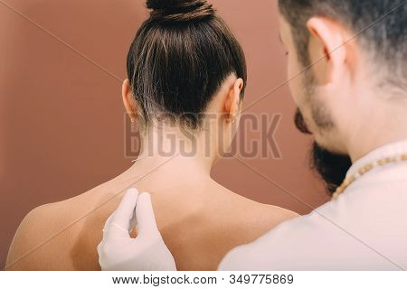 Acupuncture Needles In A Womans Spine Close-up On A Brown Background. Reflexologist Very Accurately 