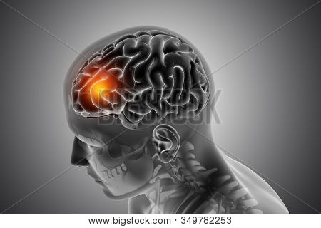 3D render of a male medical figure with front of the brain highlighted