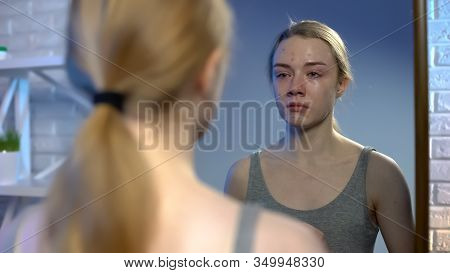 Young Female Looking At Puberty Face Acne In Mirror Reflection Feeling Depressed