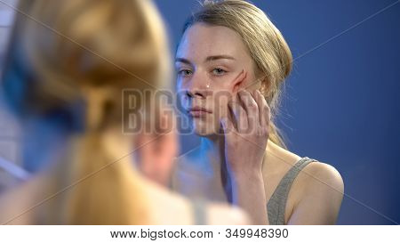 Unhappy Female Violence Victim Looking At Face Wound In Mirror, Domestic Abuse