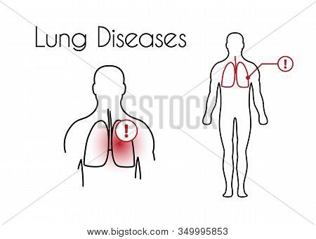 Lung Diseases Linear Icon. Vector Minimal Illustration Of Young Man With Red Lungs Suffers From Ches