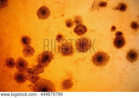 Close-up Of Blood Analysis With Microbes Under Microscope, Material Professional Laboratory Equipmen