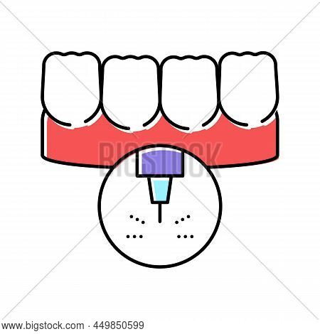 Stomatology Teeth Laser Treatment Color Icon Vector. Stomatology Teeth Laser Treatment Sign. Isolate