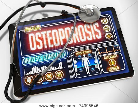 Osteoporosis on the Display of Medical Tablet.