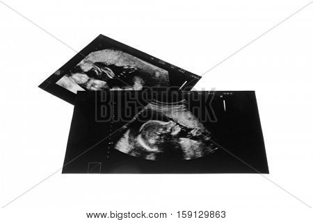 Ultrasound pictures of baby on white background