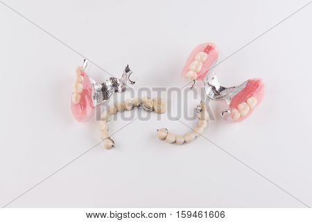 Clasp prosthesis with and attachments fixing ceramic crowns