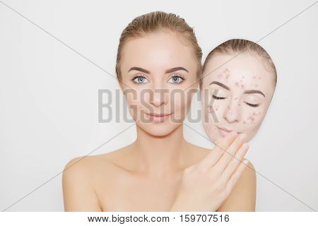 put away old  bad sking with pimples