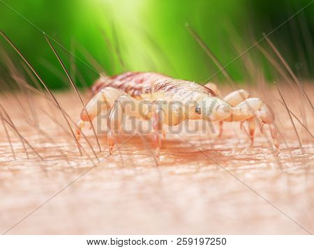3d rendered medically accurate illustration of a head louse on human skin