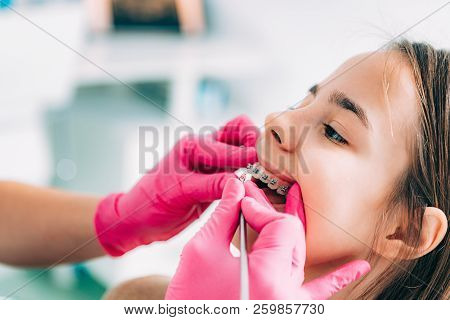 Orthodontist Checking Girl’s Dental Braces