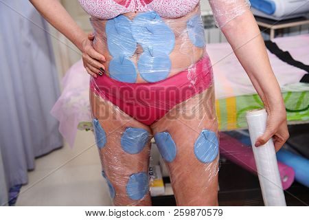 Myostimulation. Hardware Cosmetology. Body Care. Non Surgical Body Sculpting. Anti-cellulite And Ant