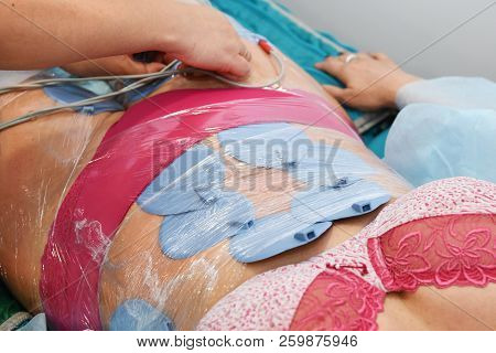 Myostimulation. Hardware Cosmetology. Body Care. Non Surgical Body Sculpting. Anti-cellulite And Ant