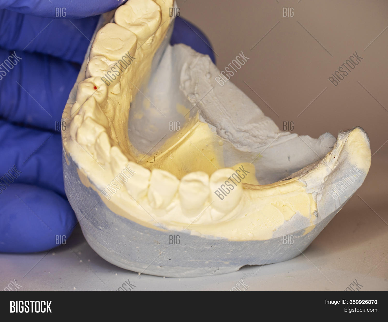 Dental Gypsum Mold Image & Photo (Free Trial) Bigstock