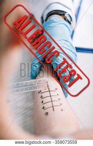 Cropped View Of Allergist Holding Ruler Near Marked Hand Of Woman With Allergic Test Illustration