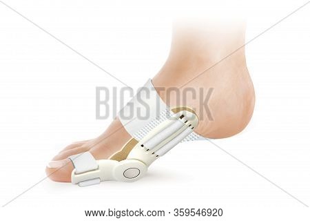 Hallux Valgus Orthopedic Medical Thumb Brace Isolated On White Background. Orthoses For Toes.