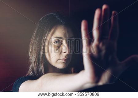 Abused Caucasian Woman With Bruises And Stitches On Her Face, With Her Arm Outstretched Her Hand Ges