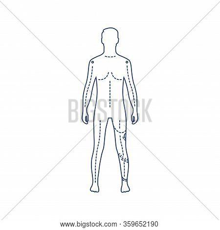 Man With Artificial Leg Black Line Icon. Person Who Has A Prosthesis Instead Of A Real Leg. Pictogra