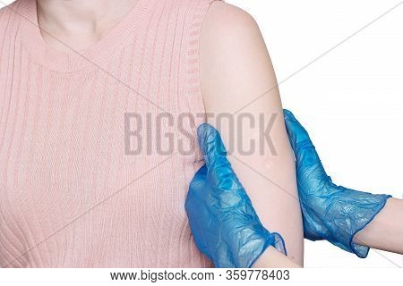 Doctor Or Nurse Examine Tuberculosis Vaccine Bcg Marks On The Shoulder Of An Adult Woman Made In Chi