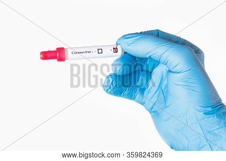 Test Tube With A Positive Test For Coronavirus