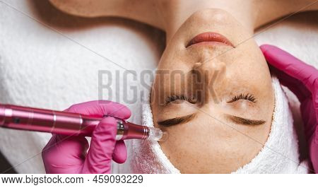 Close-up Portrait Of Cosmetologist Beauticians Hands Doing Mesotherapy With Dermapen. Microneedle Fa