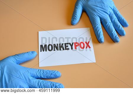 Monkeypox Virus. The Hands Of The Doctor In Blue Gloves Hold A White Paper With The Inscription 