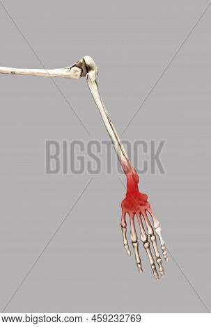 Human Skeleton Arm With Red Wrist. Sprain, Fracture, Arthritis Consequences. Arm Pain. Medical Condi